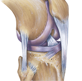 The normal human anatomy of a knee, anterolateral view. Shown are the patella, anterior cruciate ligament, patellar ligament, fibular collateral ligament, lateral meniscus, lateral femoral condyle, femur, tibia, and fibula. 